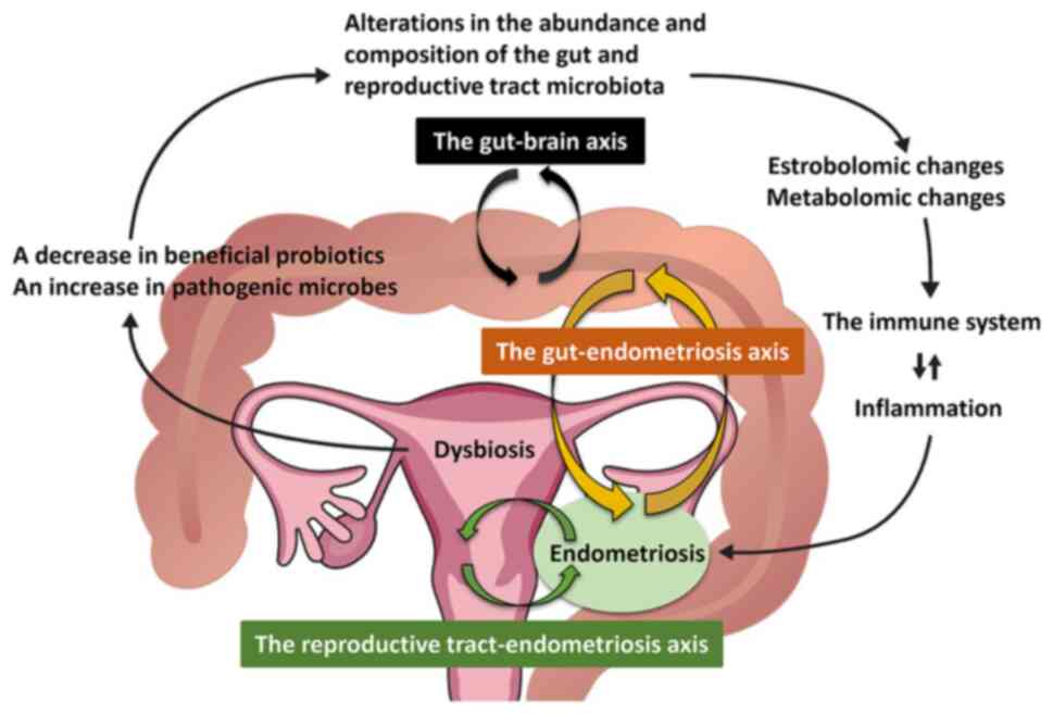 Endometriosis and Reproductive Health: Key Insights for Women