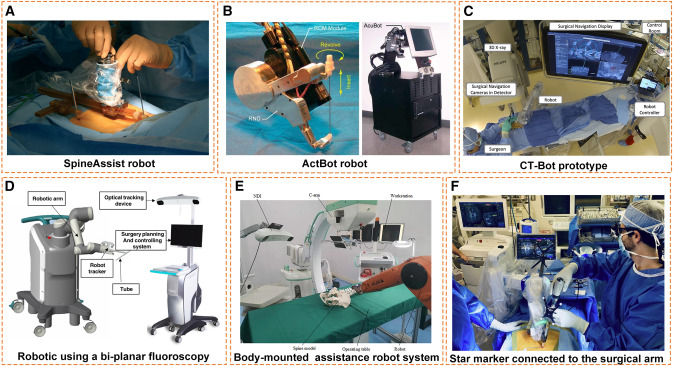 Advancements in Robotics Revolutionizing Techniques for Vascular Procedures