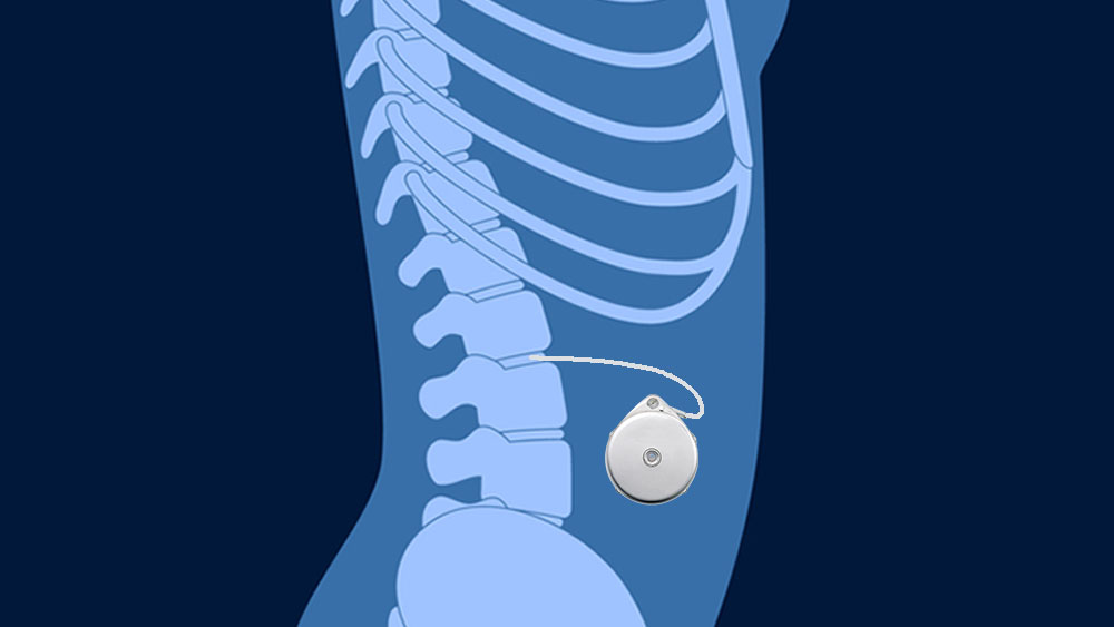 Medicine Repositioning for Improved Pain Control and Sleep Disorder Therapy