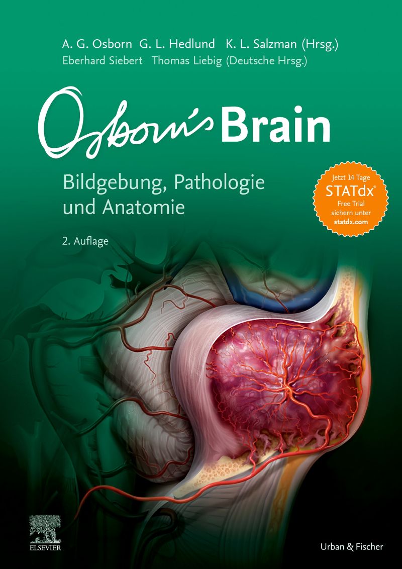 The Concealed Influence of Oral Health on Heart, Brain, and General Body Wellness