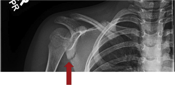 The Unseen Repercussions of Disconnection in Radiology