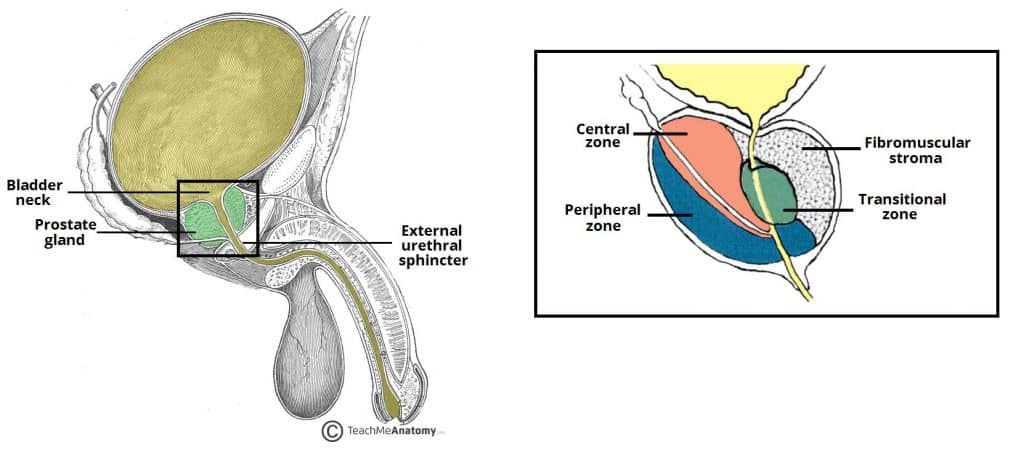 Why PSA Levels by Themselves Should Not Dictate Prostate Cancer Risk