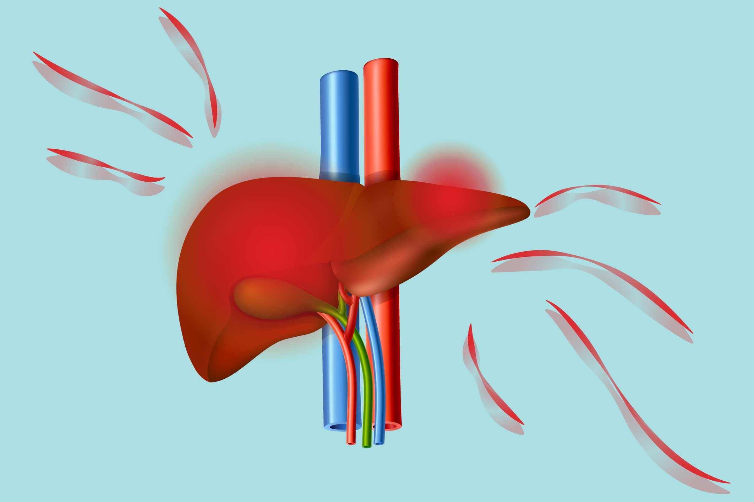 Podcast: Comprehending Fatty Liver Disease in Young Adults