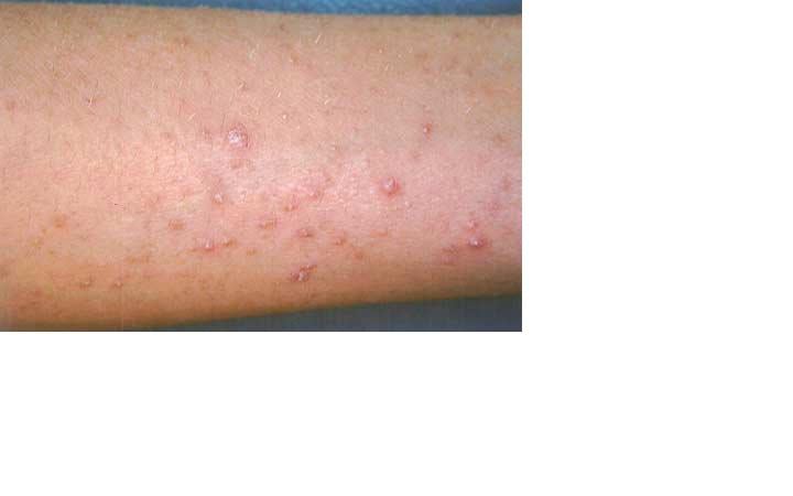 The Demand for Enhanced Dermatology Education in Primary Care