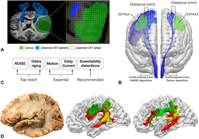 Investigating the Intricate and Essential Domain of Neurosurgery