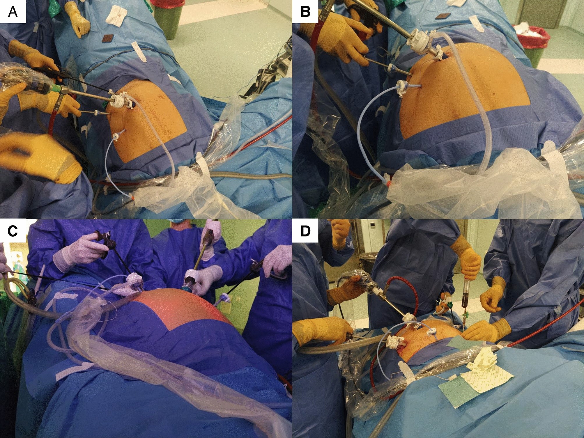 The Function of Anesthesiologists in Tackling Unneeded Medical Interventions
