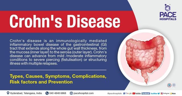 The Significance of Remaining Updated in the Progressing Management of Inflammatory Bowel Disease
