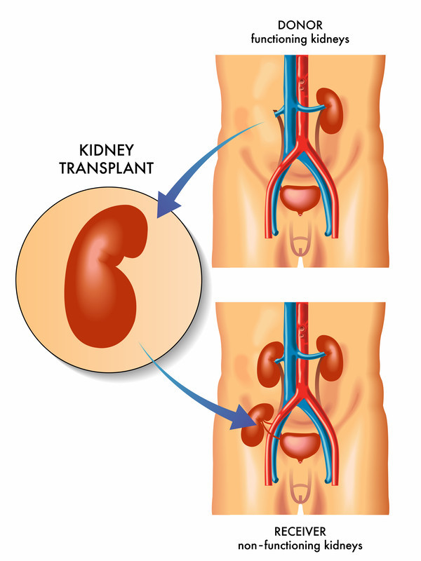 Travel Instructions for Persons with End-Stage Renal Disease