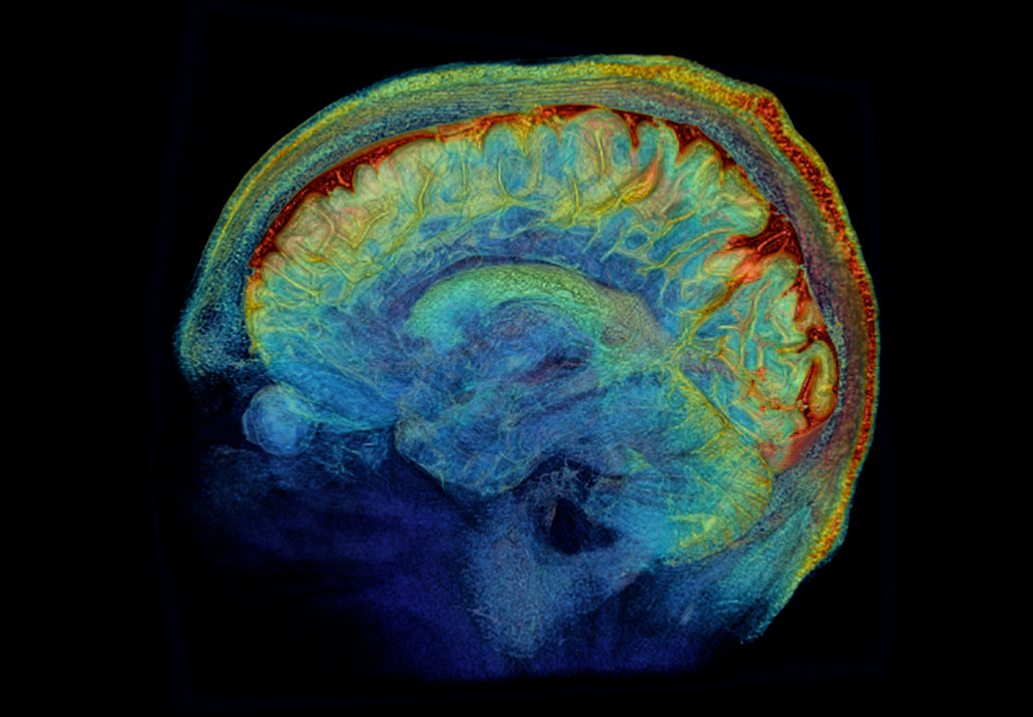 The Function of Whole-Body MRI Screening: Examining Political Impact and Progress in Healthcare